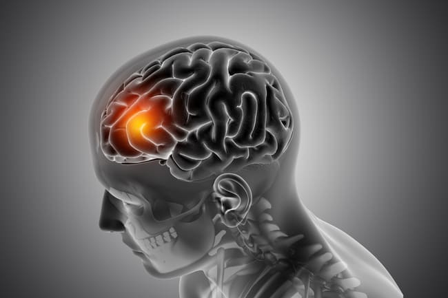 Ilustração médica de um cérebro humano com destaque em área iluminada na região frontal, simbolizando atividade cerebral.